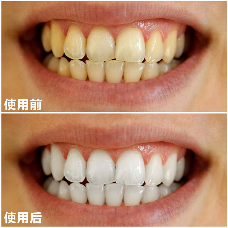 漱口水生产:探索背后的秘密