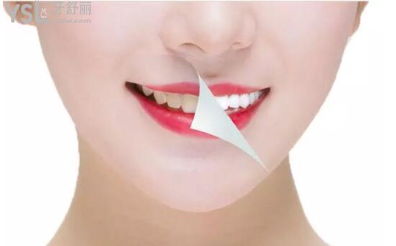 在选择适合自己的牙线时,你是否感到困惑?市场上琳琅满目的牙线品牌让人眼花缭乱。今天就让我们一起来看看几个主流品牌的优缺点吧。